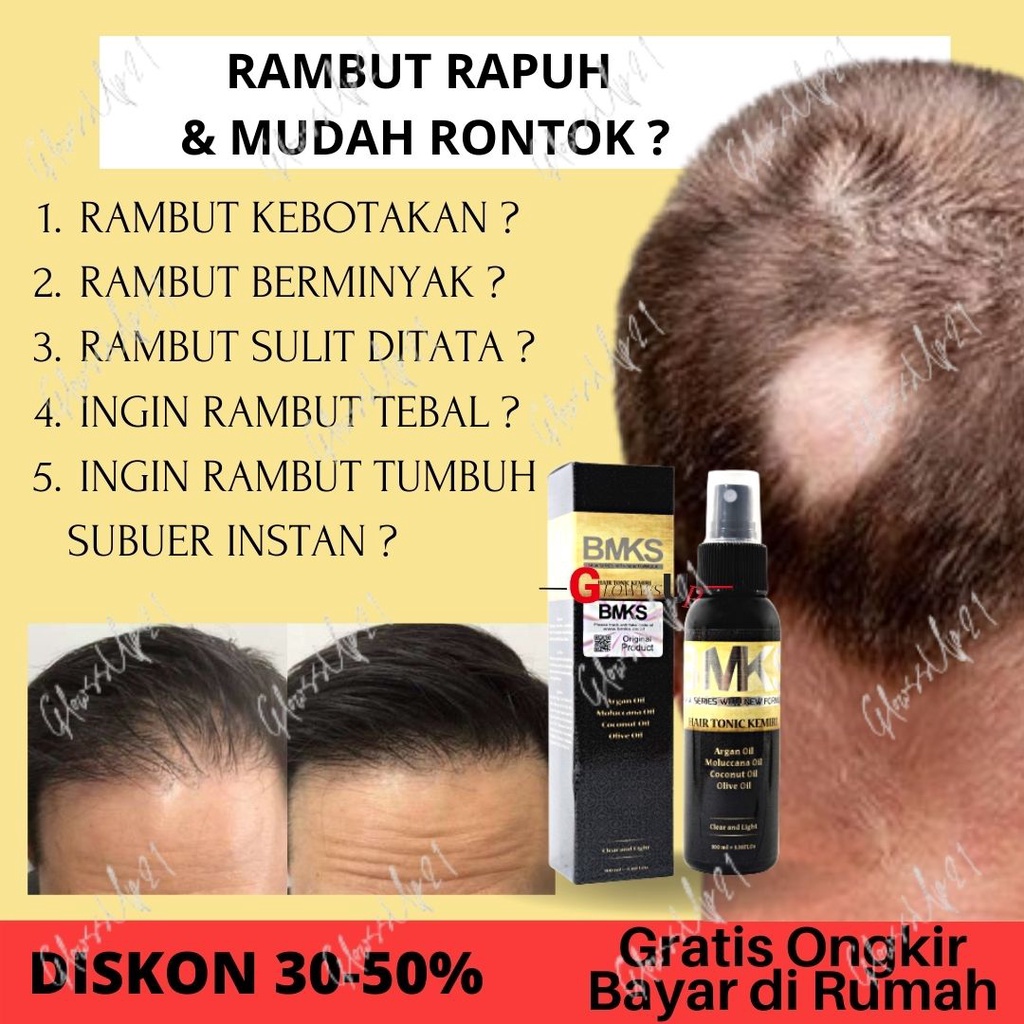 HAIR TONIC KEMIRI BMKS - HAIRTONIC PENYUBUR RAMBUT - PENUMBUH RAMBUT BOTAK