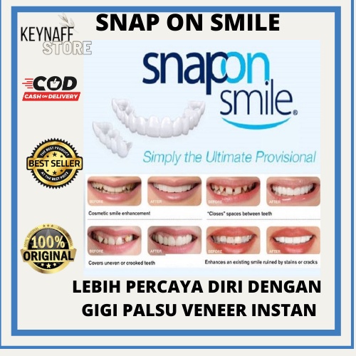 Gigi Palsu Silikon Snap On Smile Gigi Palsu 1 Set Atas Bawah 100% Original Authentic Perawatan Keseh