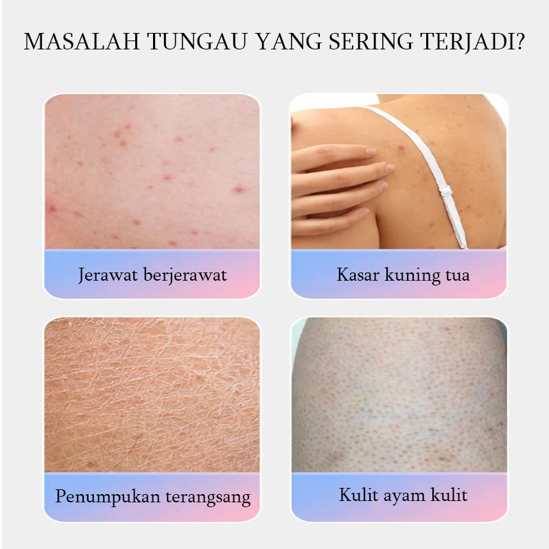 Sabun mandi jerawat Punggung Cair Sabun pemutih badan Antibakteri dan antipruritus Singkirkan tungau jerawat Wangi tahan lama Pemutih kulit Kontrol minyak dan pelembab Ekstrak herbal alami Aman &amp; tidak berbahaya