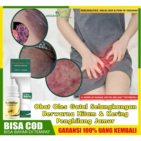 Obat Oles Gatal Selangkangan Berwarna Hitam & Kering Penghilang Jamur, Salep Memutihkan Kembali Sela