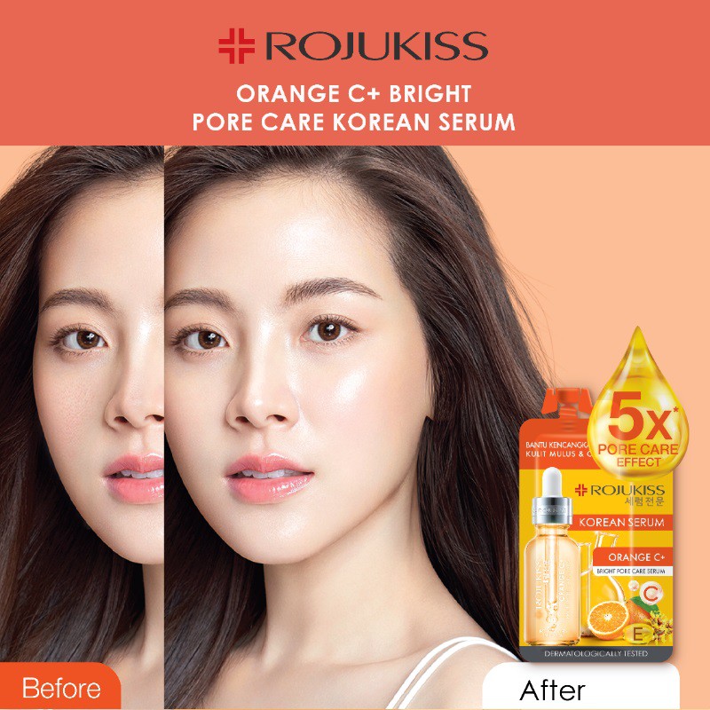 [BPOM] Rojukiss Korean Serum 8 ml [EGGPLANT | Orange C+ |Tea Tree | Jeju Lotus]