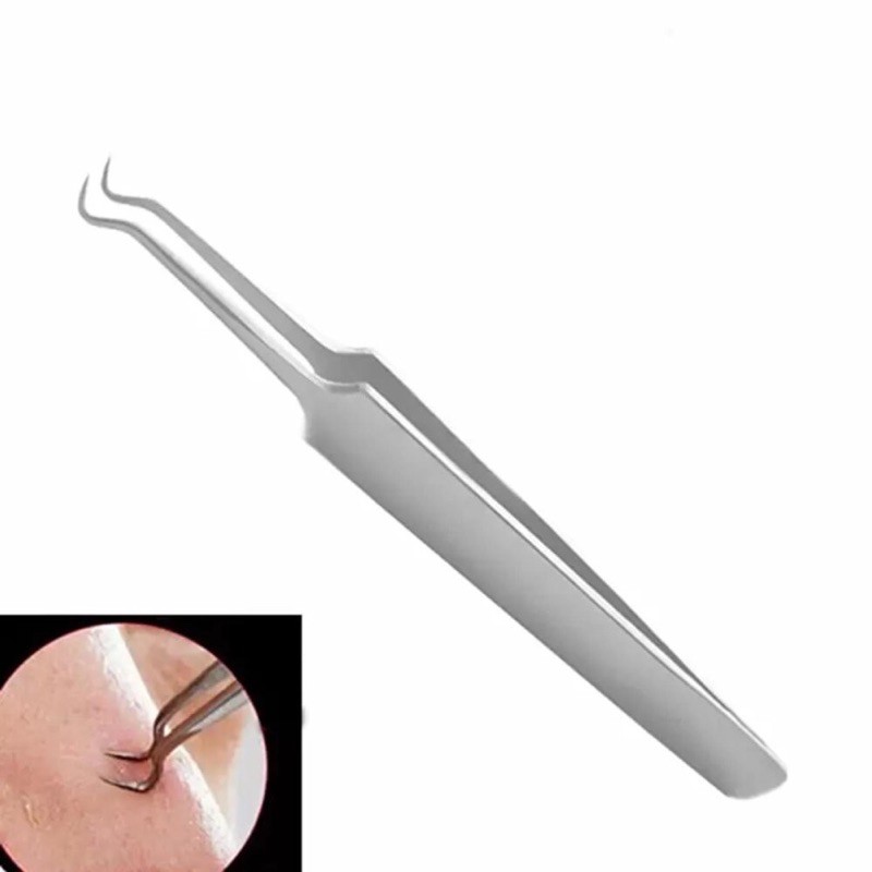 Pinset Penjepit Komedo Jepit Jerawat / pinset komedo stainless