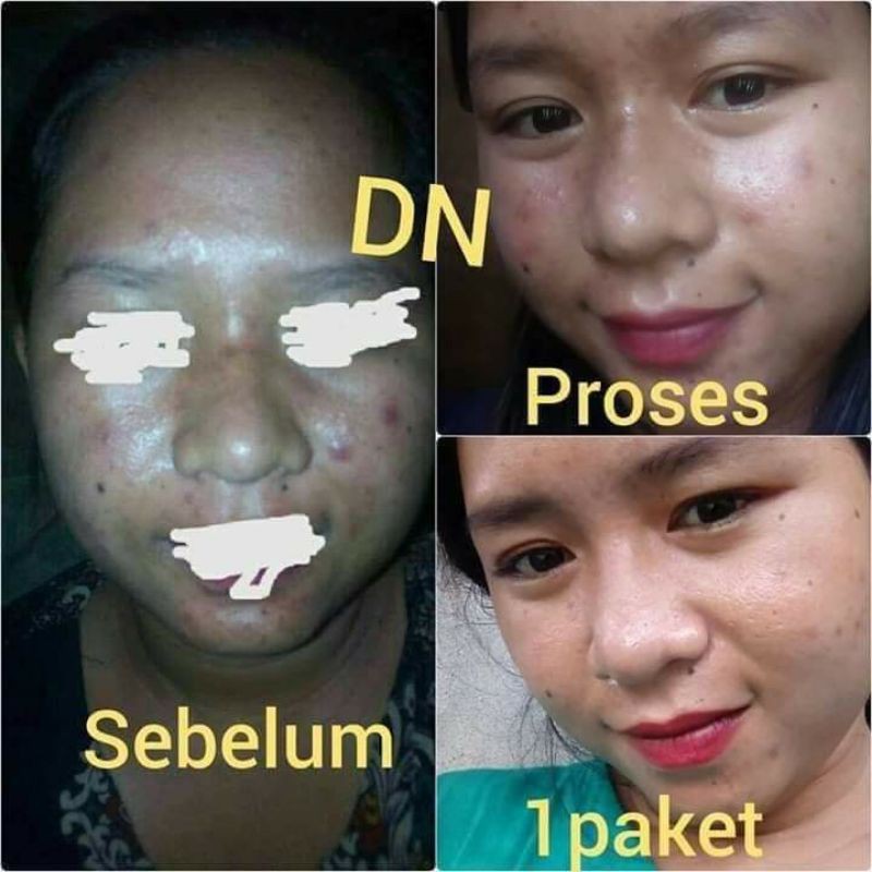 (COD) paket ekonomis cream dinda skincare