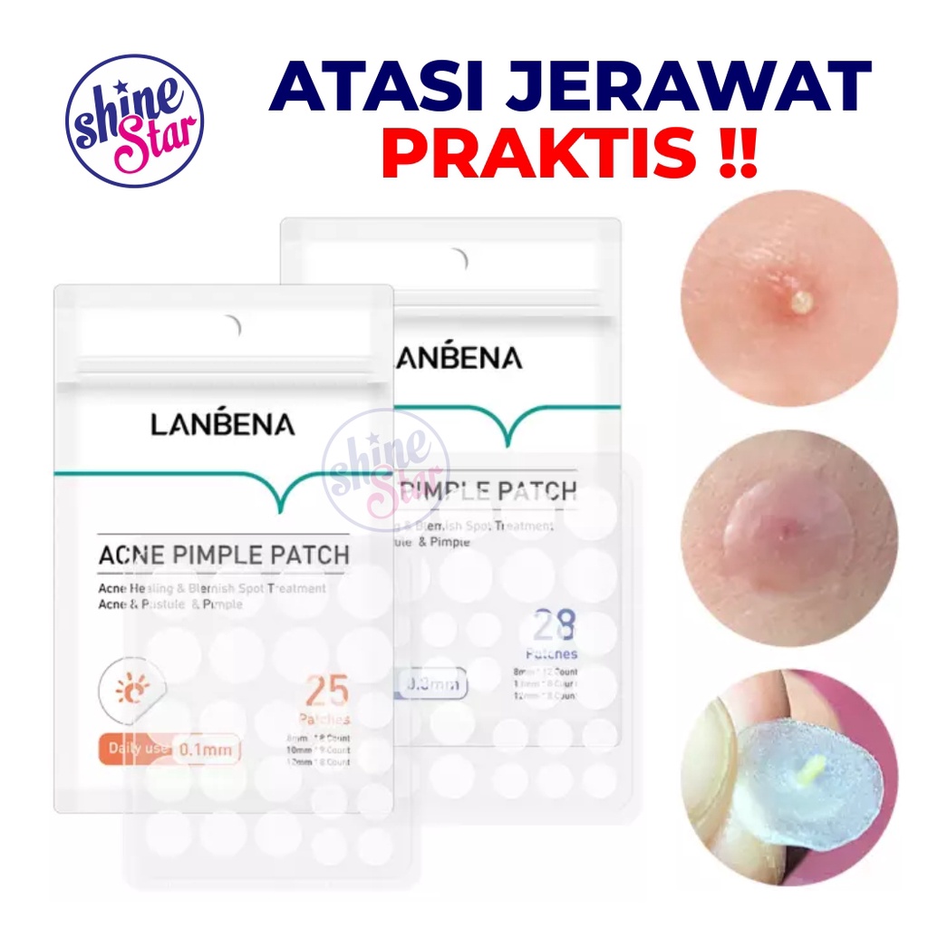 SHINE STAR - [ COD ] ANTI JERAWAT LANBENA ACNE PIMPLE PATCH DAY N NIGHT / OBATI JERAWAT CEPAT TANPA BEKAS