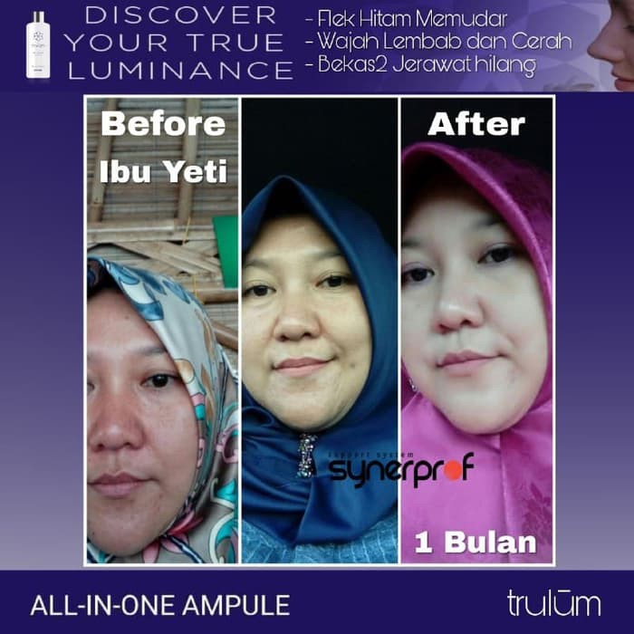 Ready Stock Trulum Synergy   Pemutih Wajah Original by USA