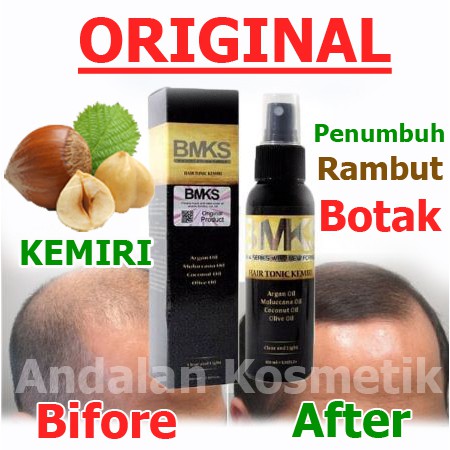 (Dijamin) Hair Tonic Penumbuh Rambut Botak BMKS TONIC Asli Original