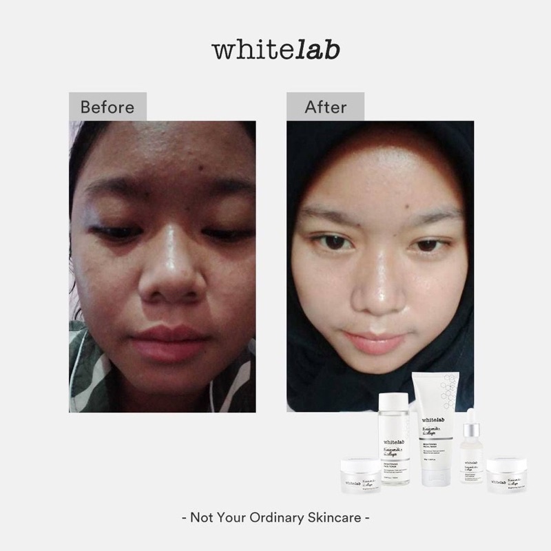 WHITELAB Brightening Serum | Toner | Day Cream | Night Cream | Face Wash | Peeling Eye Cream Mugwort