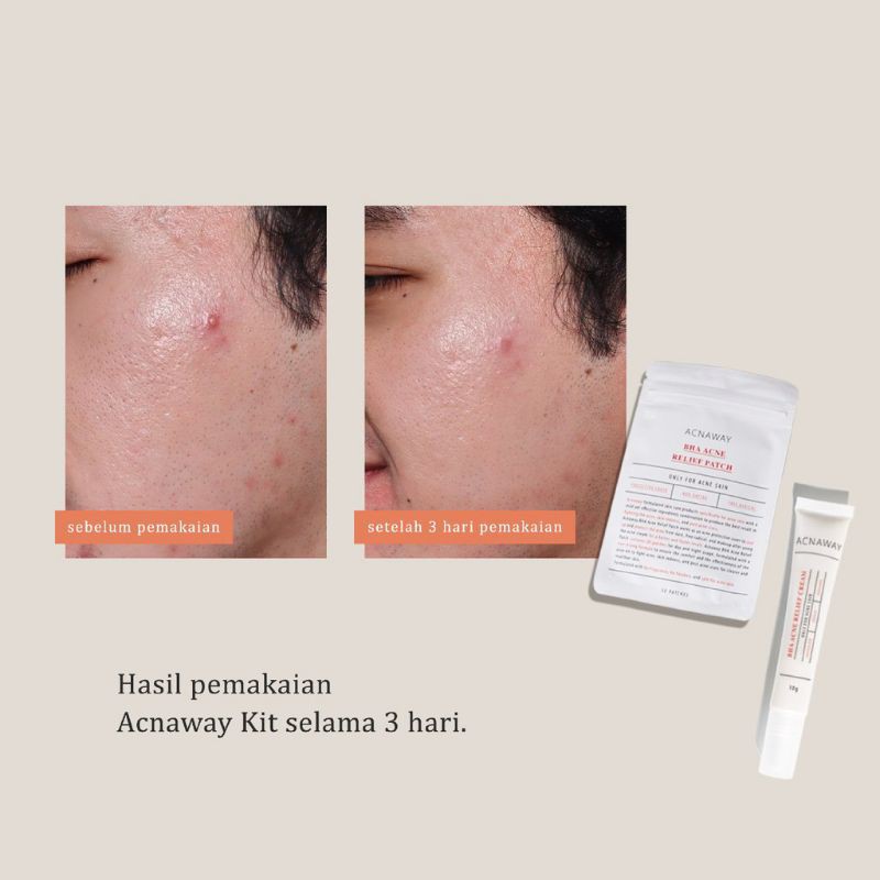 (BPOM) ACNAWAY Anti Acne and Blemish Relief Kit Acne Cream &amp; Acne Patch / ACNAWAY Stubborn Acne Cream