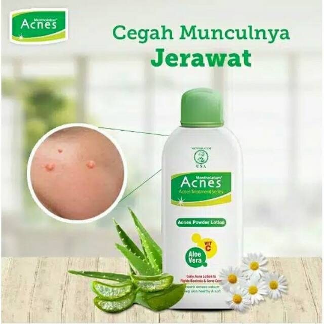 ☃Cutezz_Ching1☃Acnes Powder Lotion 100ml - Bedak Cair Pelindung Dari Jerawat