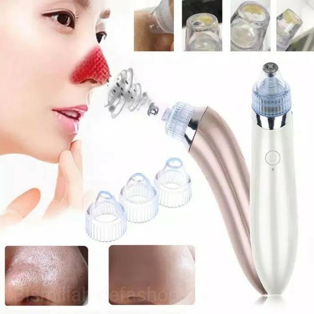 CW-666 Alat penyedot komedo/blackhead dan jerawat