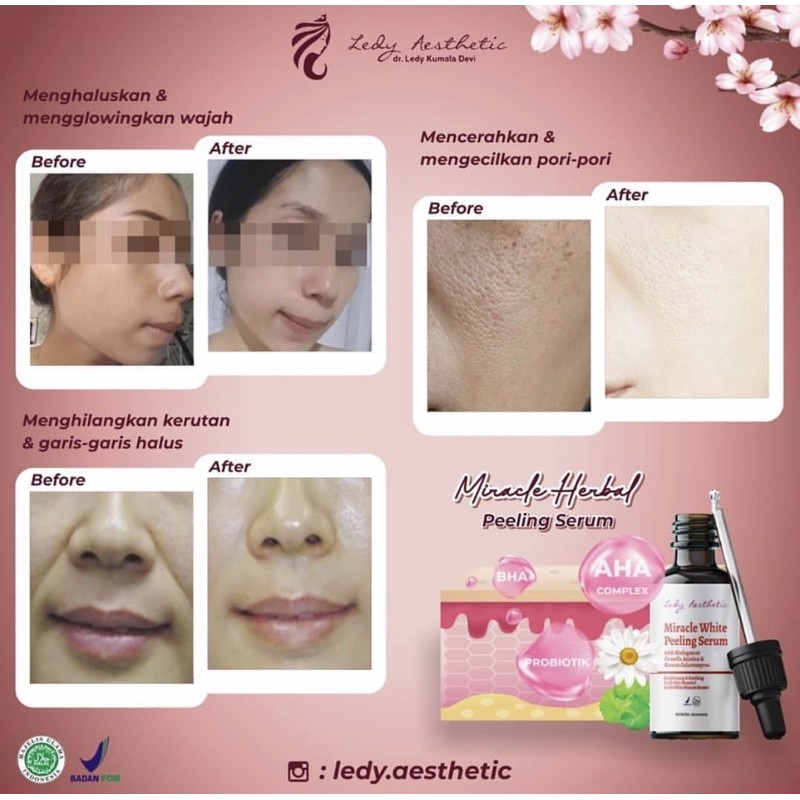 Miracle Herbal Peeling Serum