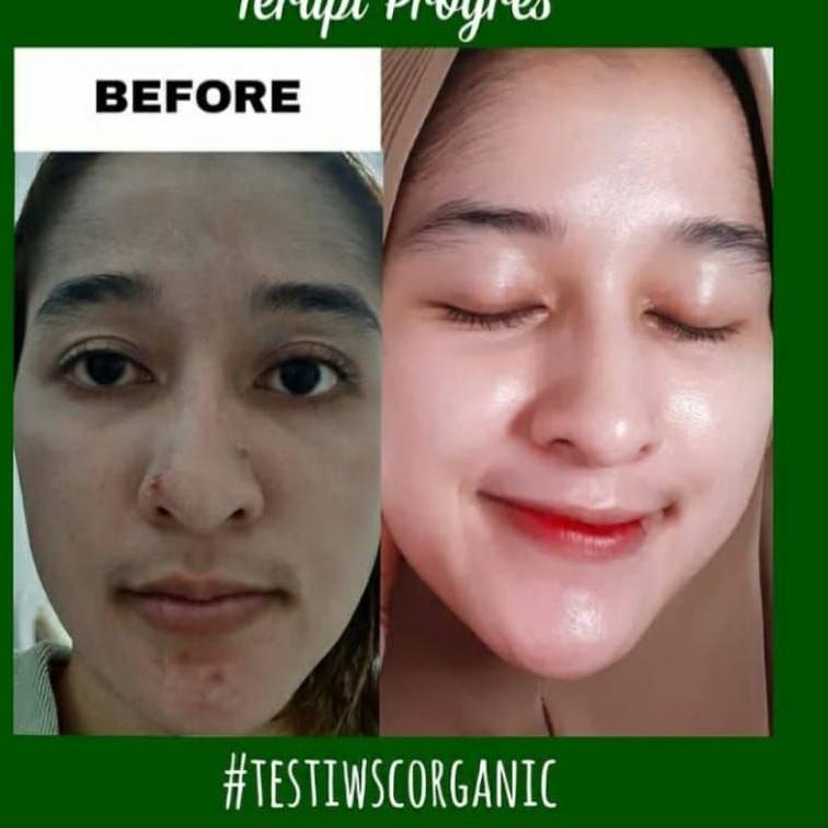 [W9I] WSC ORGANIC SKINCARE ORIGINAL BPOM /PAKET WSC ORGANIC/  CREAM WSC ORGANIK / CREAM GLOWING / CR