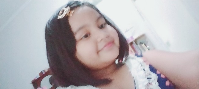 Centong Nasi Ajaib, Centong Nasi Buka Tutup Otomatis, Centong Nasi Anti Lengket