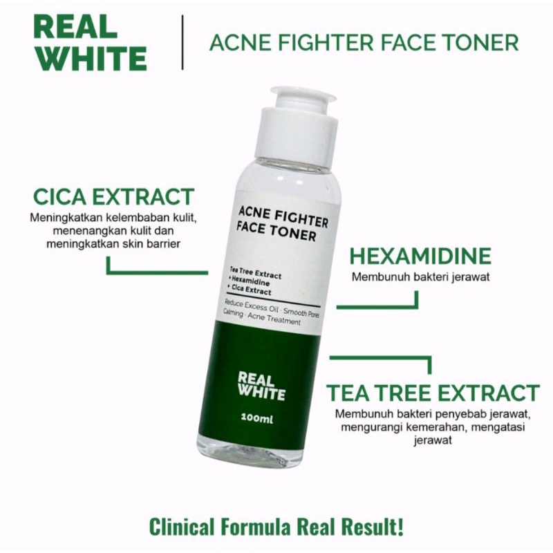 Real white acne fighter face toner/tea tree extract 100ml