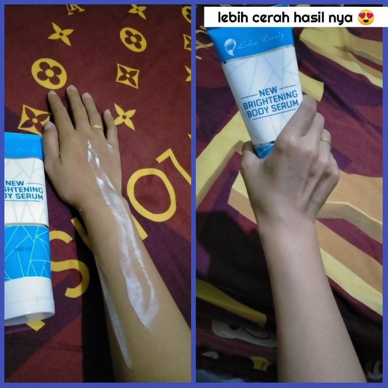 body serum kedas beauty original