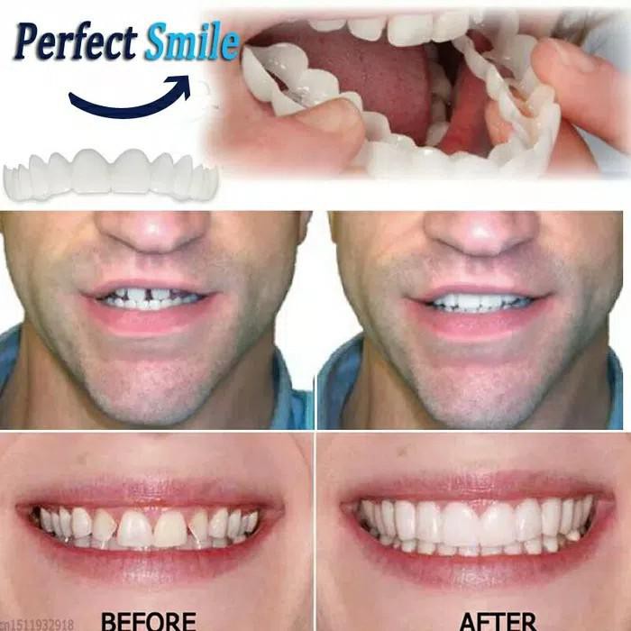 Promo Harga Murah Snap On Smile Gigi Palsu Snap Instan Perfect Smile Indonesia