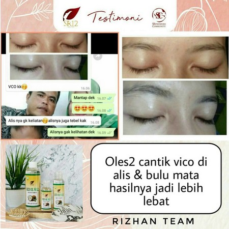 VCO VIRGIN COCONUT OIL | MINYAK KELAPA MURNI | VICO OIL SR12 | PENAMBAH IMUN TUBUH | SIAP NEW NORMAL
