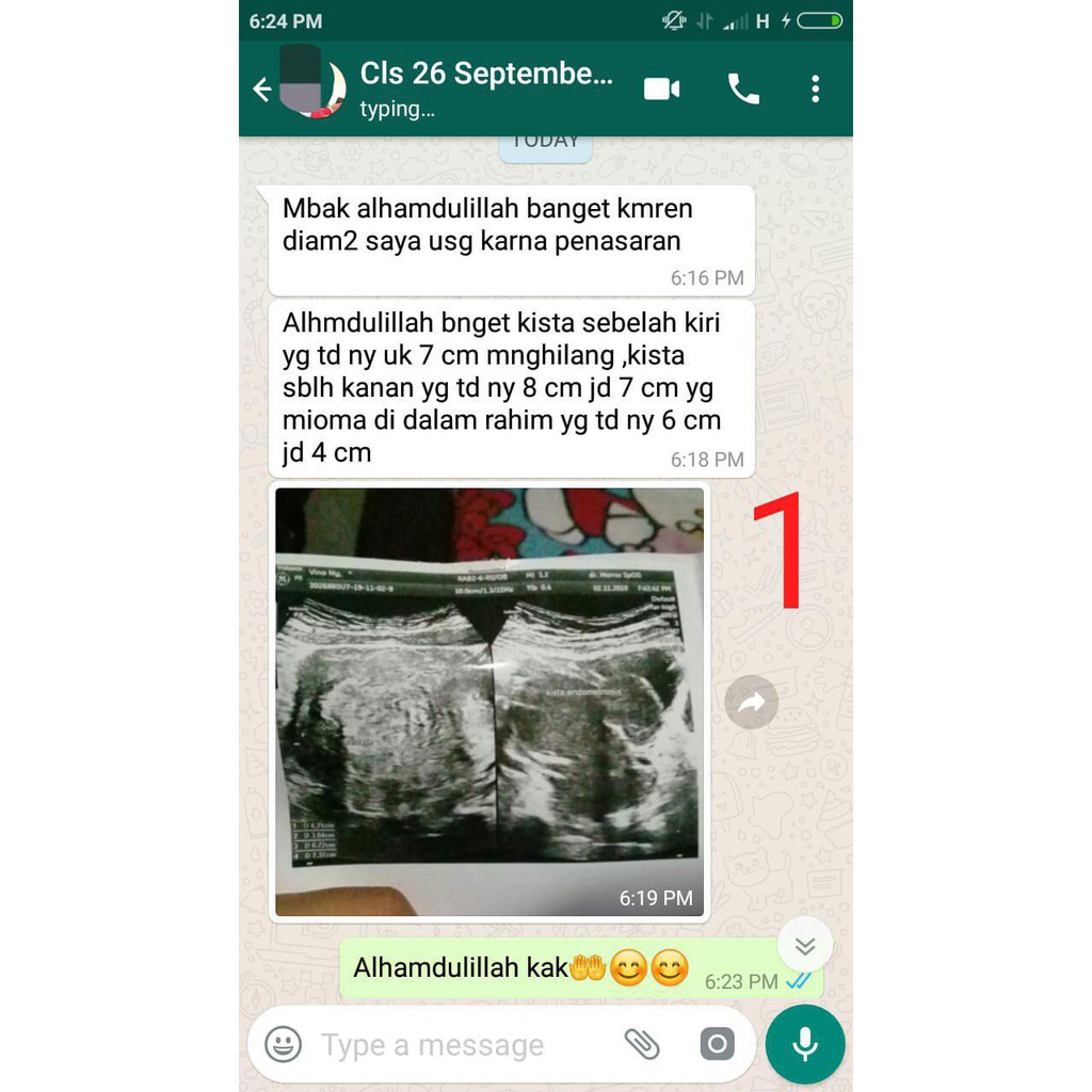 LING SHEN YAO KAPSUL - Obat Herbal Kanker - Kista - Diabetes - LINGSHENYAO Jaminan ORIGINAL per BOX-4