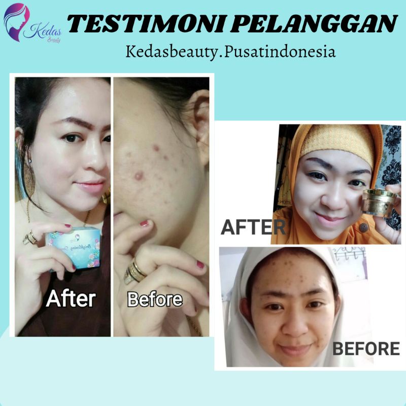 Sabun Kedas Beauty Original BPOM Sepaket Gold Jelly Kedas Beauty Pemutih Wajah Murah Cod-3
