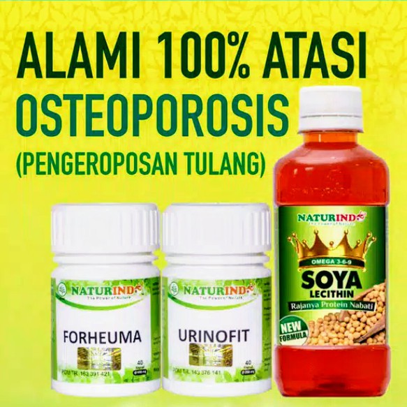 

Solusi Alami 100% Atasi Osteoporosis (Pengeroposan Tulang)
