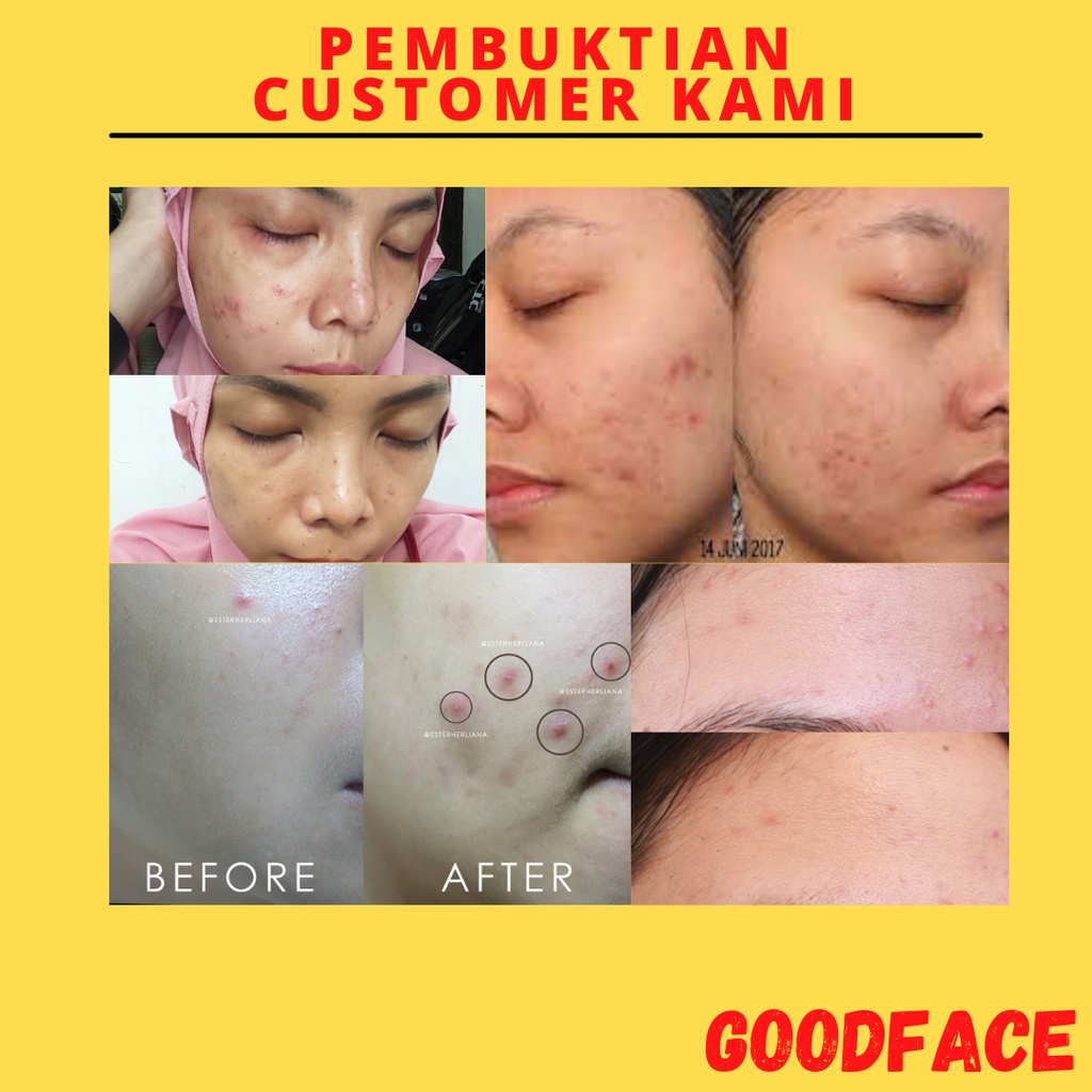 SABUN PEMUTIH WAJAH - PENGHILANG BEKAS JERAWAT - SABUN TEMULAWAK THE FACE BPOM - THE FACE SABUN TEMULAWAK ORIGINAL