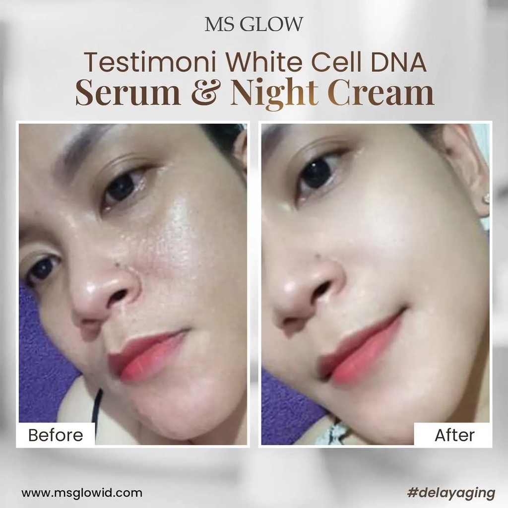 12. Serum White Cell DNA MS Glow Original Official Store