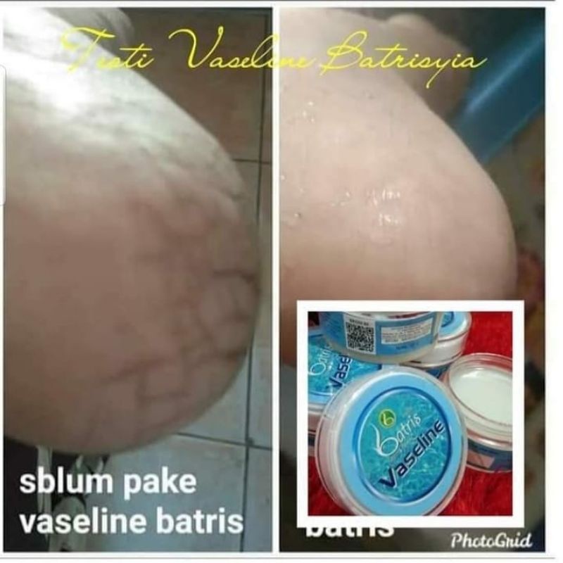 ( BISA COD ) VASELINE UNTUK KAKI PECAH PECAH/ CREAM TUMIT AMPUH/ CREAM KAKI PECAH PECAH