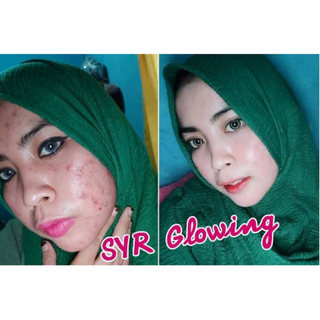 

SYAHRENI GLOWING SUPER