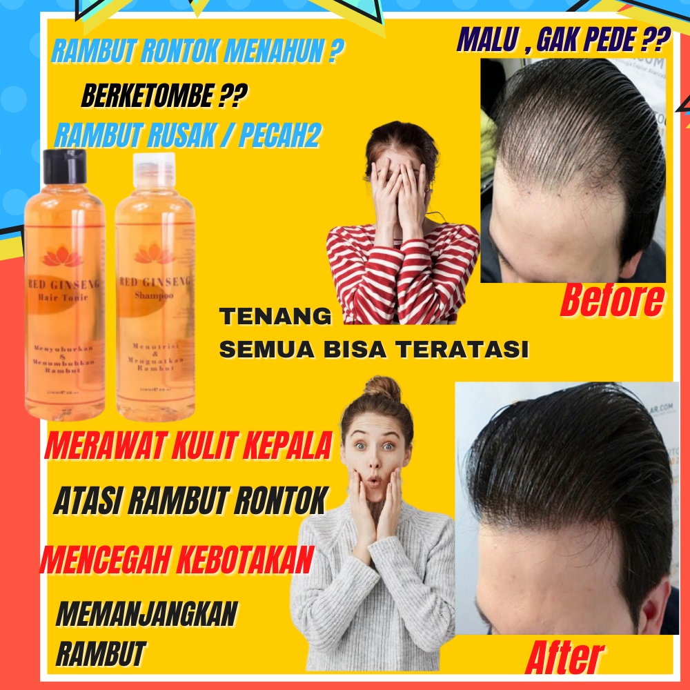 ORIGINAL! Shampoo Sampo Hair Tonic Penumbuh Penyubur Pelebat Rambut Rontok Botak Red Ginseng BPOM-1