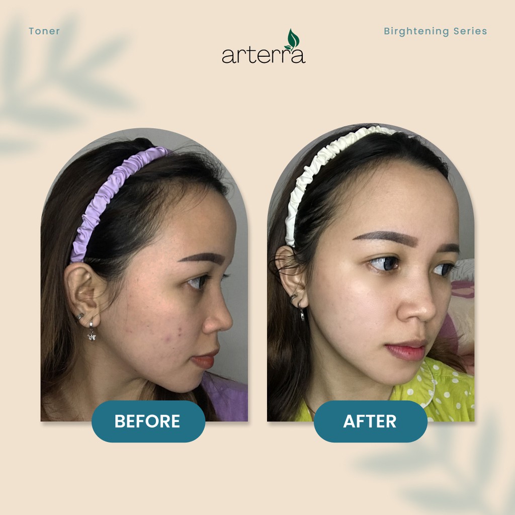 ARTERRA BRIGHTENING FACE TONER ANTI AGING | NIACINAMIDE ALPHA ARBUTIN PEMBERSIH PENCERAH KULIT WAJAH GLOWING