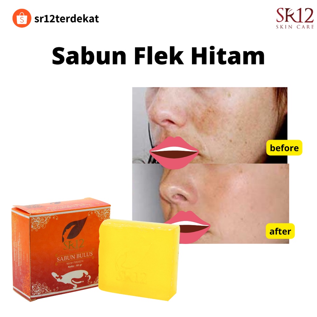 Sabun Flek  Hitam Sr12