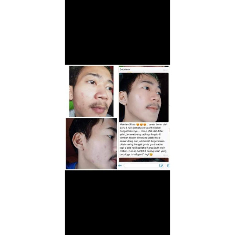 sabun leafhea 1paket isi 16pcs