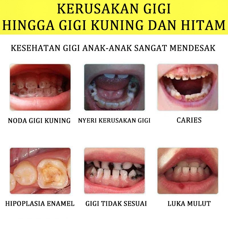 [ Asli ] pasta gigi pepsodent / pasta gigi bayi / pasta gigi anak / teeth whitening  Bahan ekstrak buah Bisa tertelan Tanpa efek samping Mencegah kerusakan gigi  pemutih gigi dan penghilang karang gigi