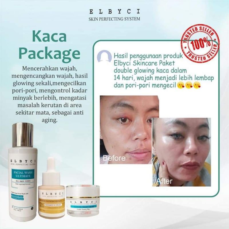 Elbyci paket kaca