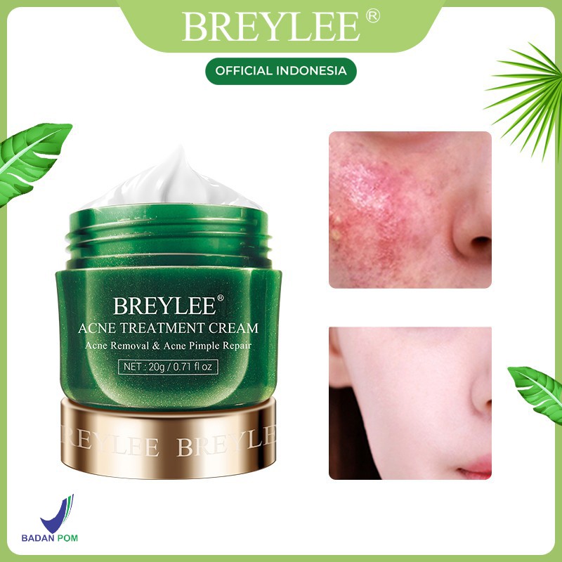 Cream Jerawat Pengangkat Komedo BREYLEE Acne Treatment Cream Krim Jerawat &amp; Komedo Wajah , Memperbaiki Kulit &amp; Mengecilkan Pori Wajah (20 g)