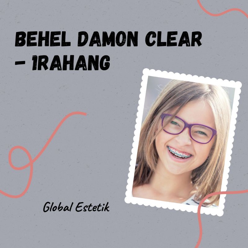Behel Damon Clear-1Rahang