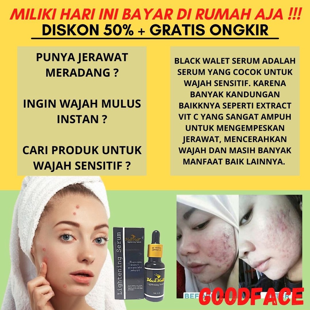 BLACK WALET LIGHTENING SERUM ORIGINAL BPOM PENGHILANG FLEK WAJAH