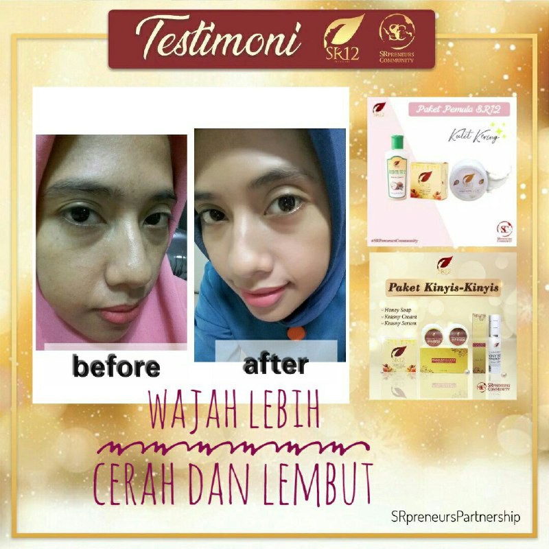 MASKER KEFIR SUSU BPOM TERBAIK SR12 MILK KEFIR ORIGINAL TERAMPUH UNTUK KULIT KUSAM &amp; KERING