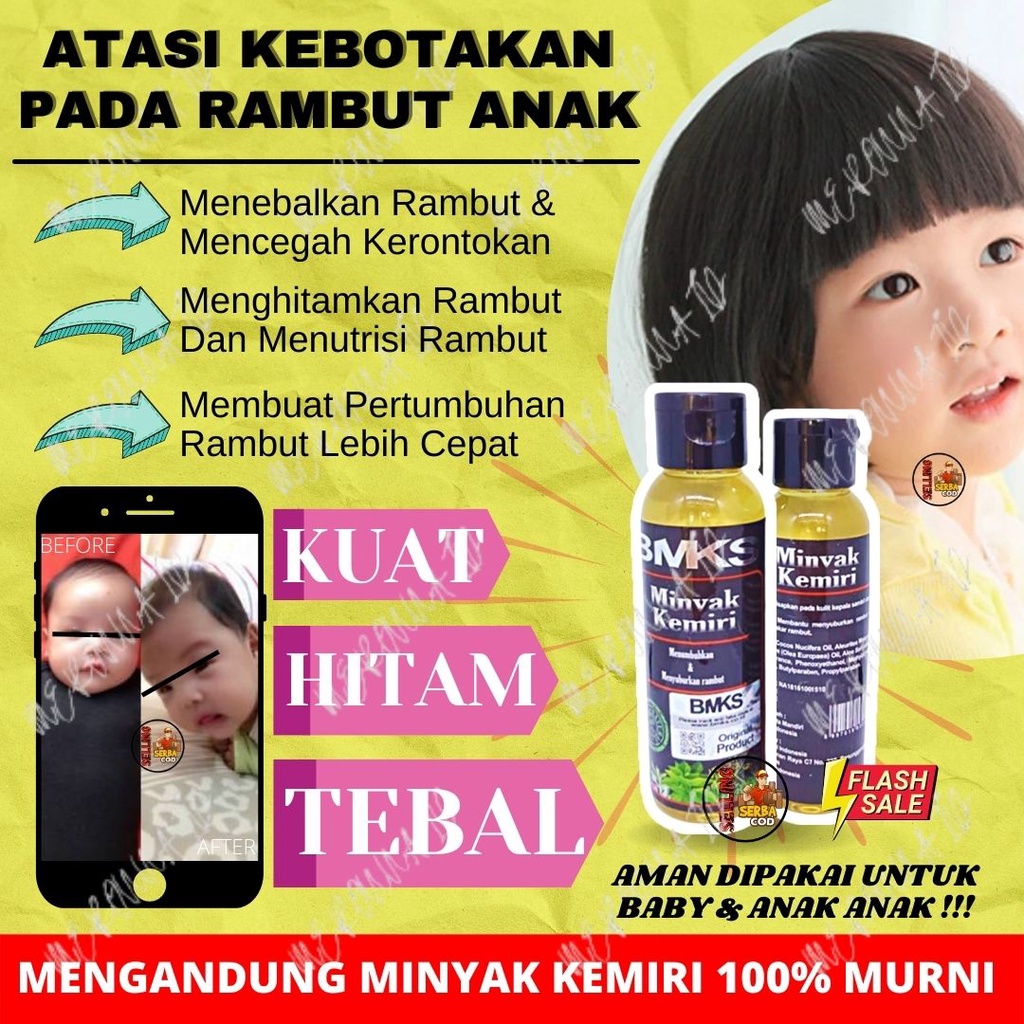 MINYAK KEMIRI MURNI - PENUMBUH RAMBUT INSTAN - PENEBAL RAMBUT - MINYAK KEMIRI BMKS 100ML ORIGINAL BP