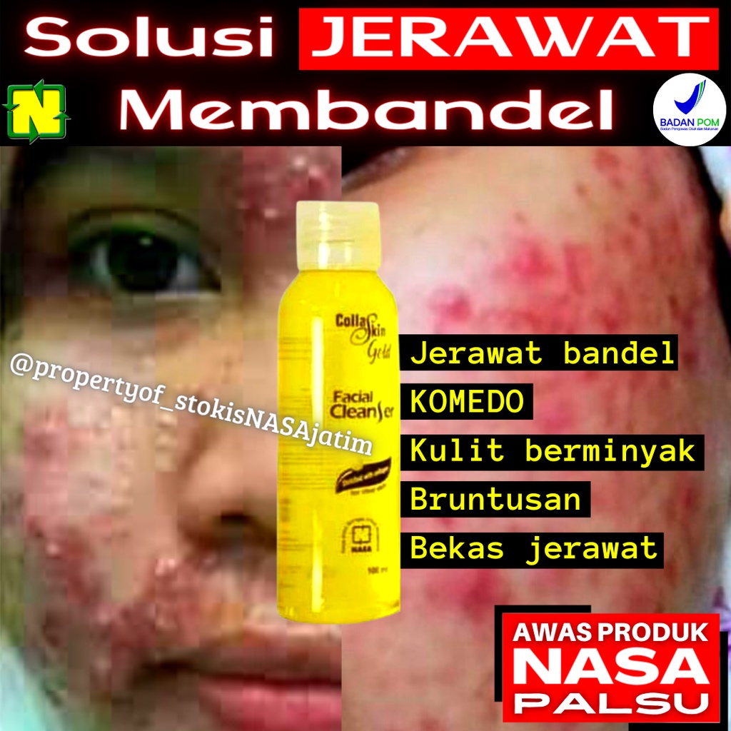 Sabun Jerawat Dan Bekas Jerawat Pria Wanita Organik Safron Soap Saffron Bopeng BREAL Sabun Safron 20