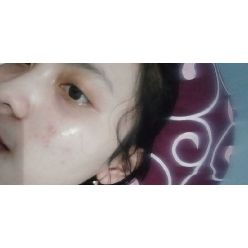 Skincare Skinglow treatment Paket  Acne Extra Glow / 6 item