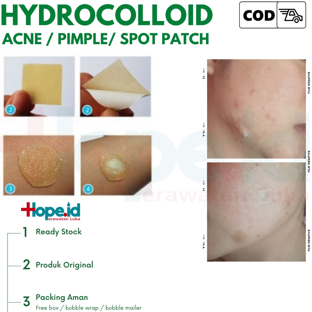 Hydrocolloid Exelcare Extra Thin 10x10cm | Perawatan Luka