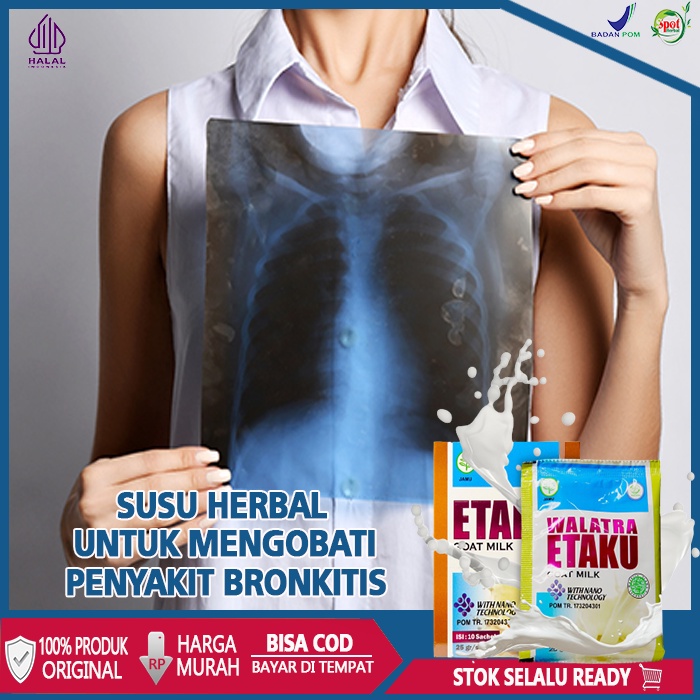 Obat Untuk Bronkitis, Susu Etaku Pembersih Paru Paru, Obat Gangguan Pernafasan, Susu Herbal Agar Mer
