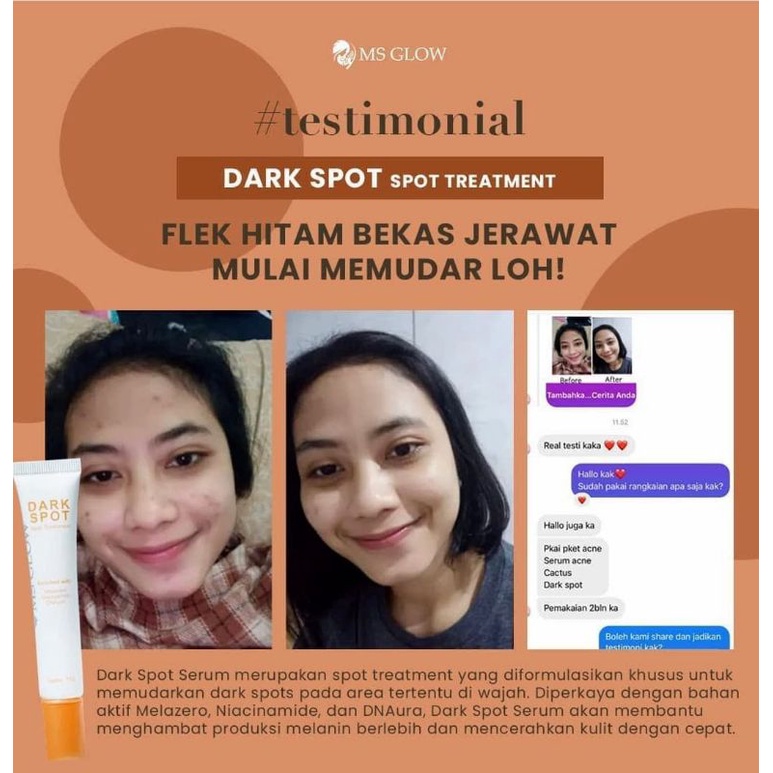 Dark Spot Treatment Serum II Khusus Flek MS GLOW