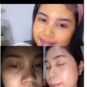 MASKER BANGKAL BY MAMA REZKY VIRAL TIKTOK