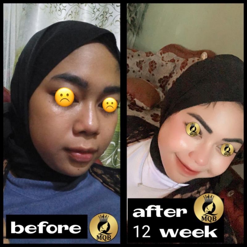 PAKET MQBeauty Brightening Series [free red jelly + cream jerawat] Skincare BPOM - MQ Beauty Krim Perawatan Wajah [Bayar Ditempat] [Asli] [Original] [Cod]-7