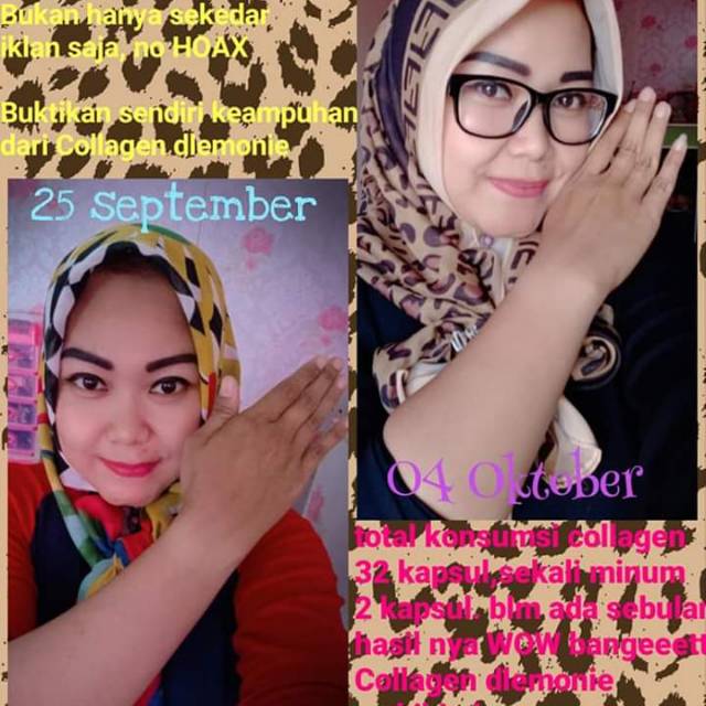 Collagen Dlemonie isi 30capsul