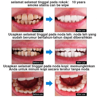 [COD]Pemutih Gigi Kuning Kerak Penghilang Karang Permanen Original Ampuh Teeth Whitening Menghapuskan plak gigi dan noda asap menghapuskan bau mulut Perawatan Mulut Menghilangkan Plak Serum Efektif Untuk Pemutihan Gigi 4.8