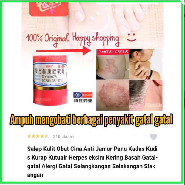 Obat Kulit Obat Gatal Kulit Exsims | Salep KL BL PKW Asli - Obat Gatal Kulit Exsims Eksim Menahun