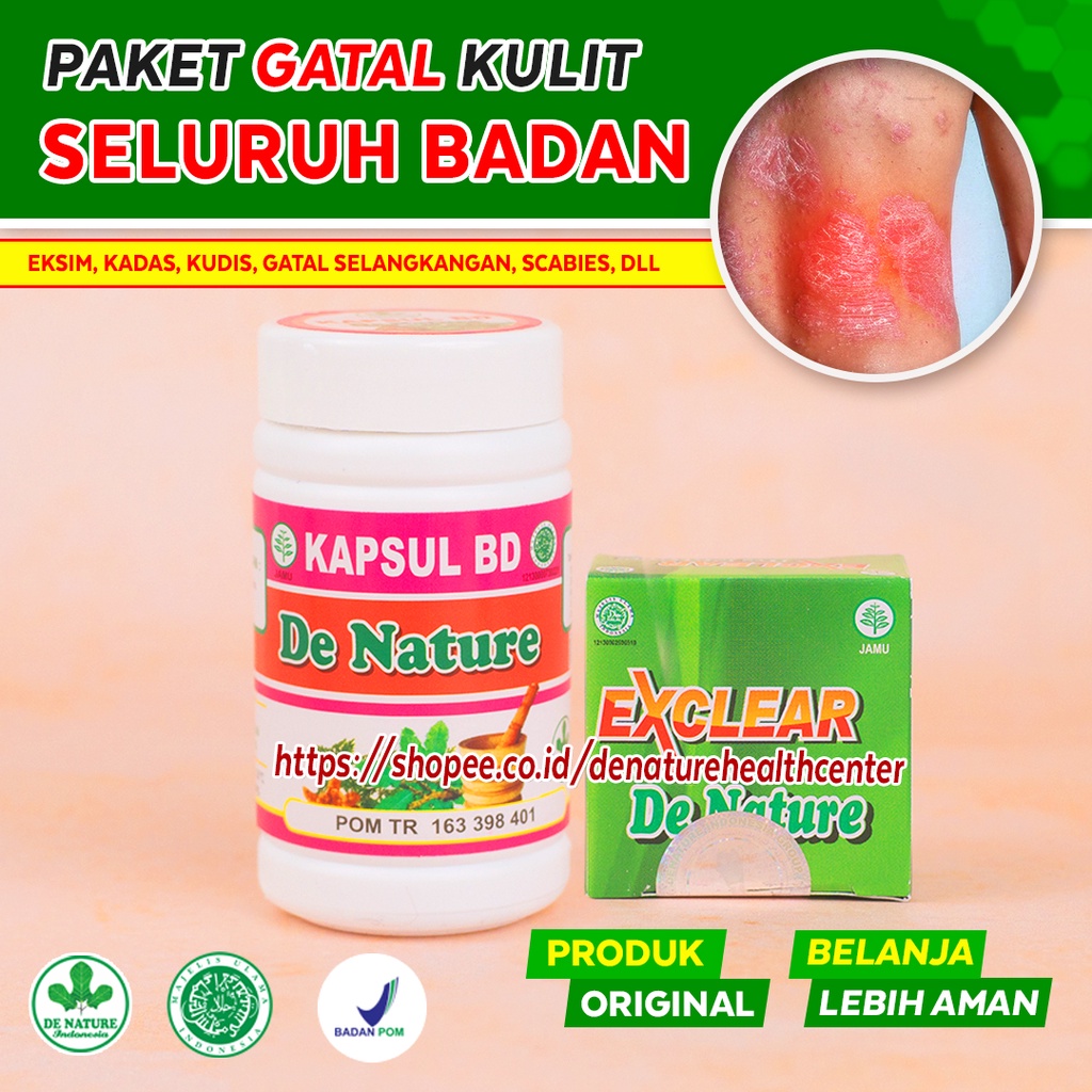 Obat Khusus Gatal Kulit Eksim Kering Menahun Gatal2 Kemaluan Paling Ampuh Untuk Anak Pria & Wanita S